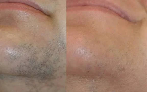 Wiki Special Hair Blocker