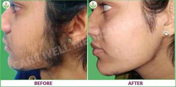 Wiki Special Hair Blocker