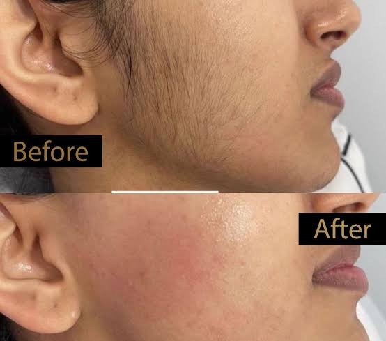 Wiki Special Hair Blocker